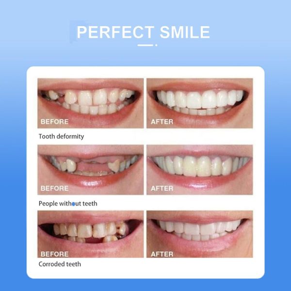 Snap-on Smile: Instant Confidence with a Brighter, Whiter Smile β Free Delivery!