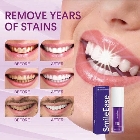 Teeth Brightening HiSmile V34 Colour Corrector Serum (30ml) β Achieve a Radiant Smile with Free Delivery